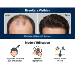 Minoxidil Kirkland 5% – 6 Bouteilles 3 Ajouter un titre 25